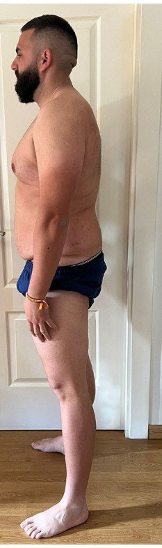 Transformación Ismael - después