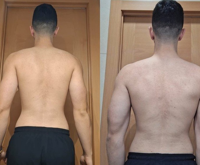 Transformación Miguel - antes y después espalda